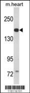 Corin, Serine Peptidase antibody, 62-511, ProSci, Western Blot image 