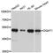 DGAT1 antibody, MBS129929, MyBioSource, Western Blot image 