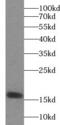 Neuroglobin antibody, FNab05718, FineTest, Western Blot image 