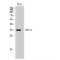 CD32a antibody, LS-C382544, Lifespan Biosciences, Western Blot image 