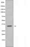 Matrix Metallopeptidase 15 antibody, orb224407, Biorbyt, Western Blot image 