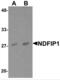 NEDD4 family-interacting protein 1 antibody, NBP2-82012, Novus Biologicals, Western Blot image 
