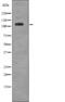 EPH Receptor A6 antibody, abx215183, Abbexa, Western Blot image 