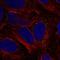 Monocyte To Macrophage Differentiation Associated antibody, HPA026978, Atlas Antibodies, Immunofluorescence image 