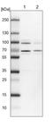 Pre-MRNA Processing Factor 39 antibody, NBP1-83774, Novus Biologicals, Western Blot image 
