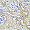 Biogenesis Of Lysosomal Organelles Complex 1 Subunit 3 antibody, 16-904, ProSci, Immunohistochemistry paraffin image 