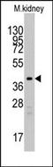 Transforming Growth Factor Beta Regulator 1 antibody, AP13465PU-N, Origene, Western Blot image 