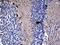 MCF.2 Cell Line Derived Transforming Sequence antibody, LS-C793024, Lifespan Biosciences, Immunohistochemistry paraffin image 