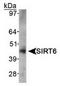 Sirtuin 6 antibody, TA301523, Origene, Western Blot image 