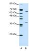 Grainyhead Like Transcription Factor 3 antibody, NBP1-80356, Novus Biologicals, Western Blot image 