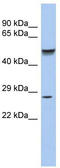 Paired Like Homeobox 2A antibody, TA329897, Origene, Western Blot image 