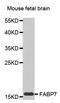 Fatty Acid Binding Protein 7 antibody, A02646-1, Boster Biological Technology, Western Blot image 
