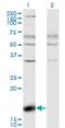 Z-DNA Binding Protein 1 antibody, H00081030-M01, Novus Biologicals, Western Blot image 