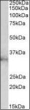 Chloride Intracellular Channel 1 antibody, orb375531, Biorbyt, Western Blot image 
