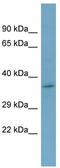 GHBP antibody, TA334655, Origene, Western Blot image 
