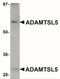 ADAMTS Like 5 antibody, NBP2-41120, Novus Biologicals, Western Blot image 