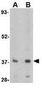 F-Box And Leucine Rich Repeat Protein 20 antibody, GTX31331, GeneTex, Western Blot image 