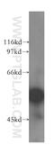 Glypican-1 antibody, 16700-1-AP, Proteintech Group, Western Blot image 