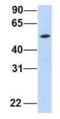 Family With Sequence Similarity 98 Member A antibody, NBP1-56782, Novus Biologicals, Western Blot image 