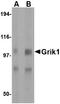 Glutamate Ionotropic Receptor Kainate Type Subunit 1 antibody, AP22601PU-N, Origene, Western Blot image 
