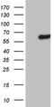 Leucine Rich Repeat Containing 6 antibody, TA806108, Origene, Western Blot image 