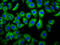 FcRIIIb antibody, LS-C680469, Lifespan Biosciences, Immunofluorescence image 