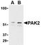 Aldo-Keto Reductase Family 1 Member D1 antibody, orb5719, Biorbyt, Western Blot image 