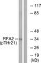 RPA34 antibody, PA5-38510, Invitrogen Antibodies, Western Blot image 