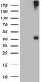 1-Acylglycerol-3-Phosphate O-Acyltransferase 5 antibody, TA504144S, Origene, Western Blot image 
