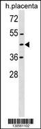 Zinc Finger Protein 558 antibody, 59-884, ProSci, Western Blot image 