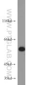 Histone Deacetylase 2 antibody, 12922-3-AP, Proteintech Group, Western Blot image 