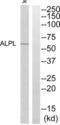 Alkaline Phosphatase, Biomineralization Associated antibody, abx015103, Abbexa, Western Blot image 