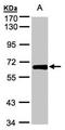 Zinc Finger Protein 169 antibody, orb69916, Biorbyt, Western Blot image 