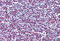 Histone Cluster 1 H2A Family Member M antibody, MBS244101, MyBioSource, Immunohistochemistry paraffin image 