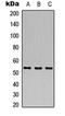 Cdc42 Guanine Nucleotide Exchange Factor 9 antibody, orb235022, Biorbyt, Western Blot image 