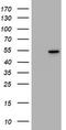 Vimentin antibody, CF801358, Origene, Western Blot image 
