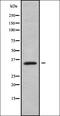 Immunoglobulin Mu DNA Binding Protein 2 antibody, orb338250, Biorbyt, Western Blot image 