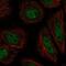 Zinc Finger Protein Y-Linked antibody, NBP2-57923, Novus Biologicals, Immunofluorescence image 