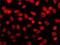 Histone Deacetylase 2 antibody, MA1-25451, Invitrogen Antibodies, Immunofluorescence image 