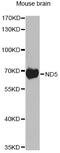 NADH-ubiquinone oxidoreductase chain 5 antibody, MBS9128307, MyBioSource, Western Blot image 
