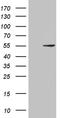 Pancreatic Lipase antibody, TA811702S, Origene, Western Blot image 
