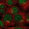 Leucine Rich Repeat Containing 28 antibody, NBP2-48706, Novus Biologicals, Immunocytochemistry image 
