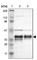 Chromosome 1 Open Reading Frame 198 antibody, HPA004798, Atlas Antibodies, Western Blot image 