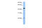 EWS RNA Binding Protein 1 antibody, 29-414, ProSci, Enzyme Linked Immunosorbent Assay image 