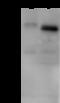 Regulator Of G Protein Signaling 7 antibody, 310712-T36, Sino Biological, Western Blot image 