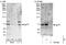 Autocrine motility factor receptor, isoform 1 antibody, NBP1-49986, Novus Biologicals, Western Blot image 