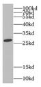 C9orf72-SMCR8 Complex Subunit antibody, FNab01148, FineTest, Western Blot image 