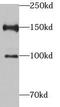 PHD Finger Protein 2 antibody, FNab06384, FineTest, Western Blot image 