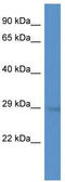 Gem Nuclear Organelle Associated Protein 2 antibody, TA345722, Origene, Western Blot image 