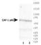 Chromatin assembly factor 1 subunit B antibody, TA336654, Origene, Western Blot image 
